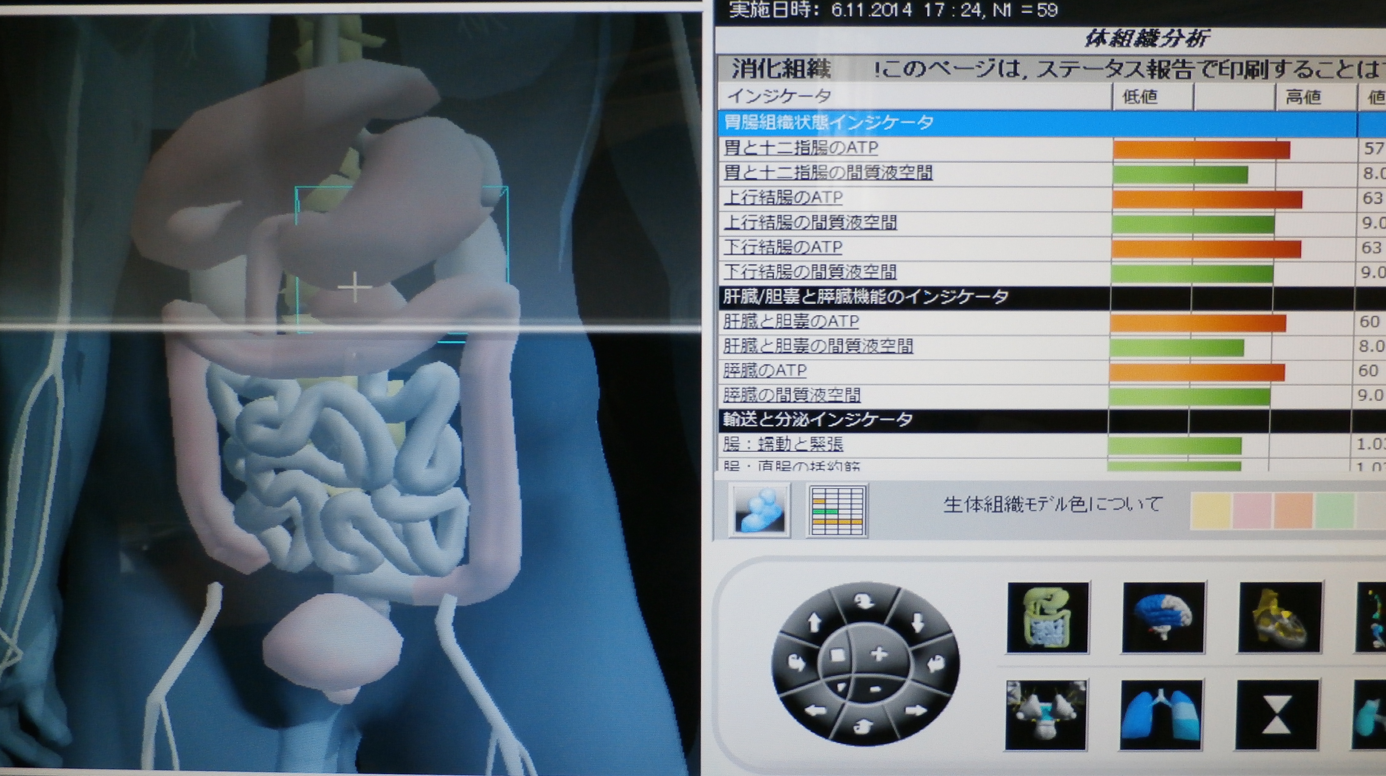 高次元人間ドック SKY-10 イメージ5